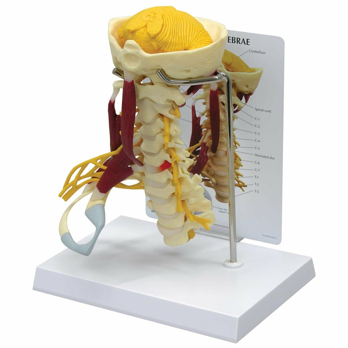 Deluxe Muscled Cervical Spine Vertebrae Model Deluxe Muscled Cervical Spine Vertebrae Model