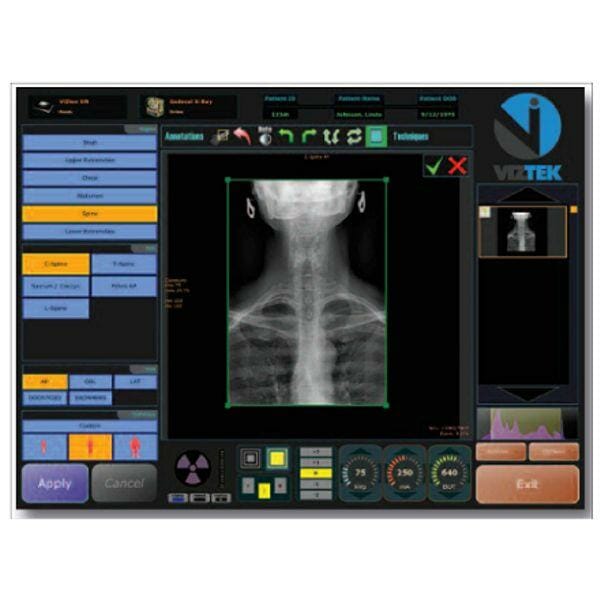 Digital X-Ray System with Installation & Training Digital X-Ray System with Installation & Training