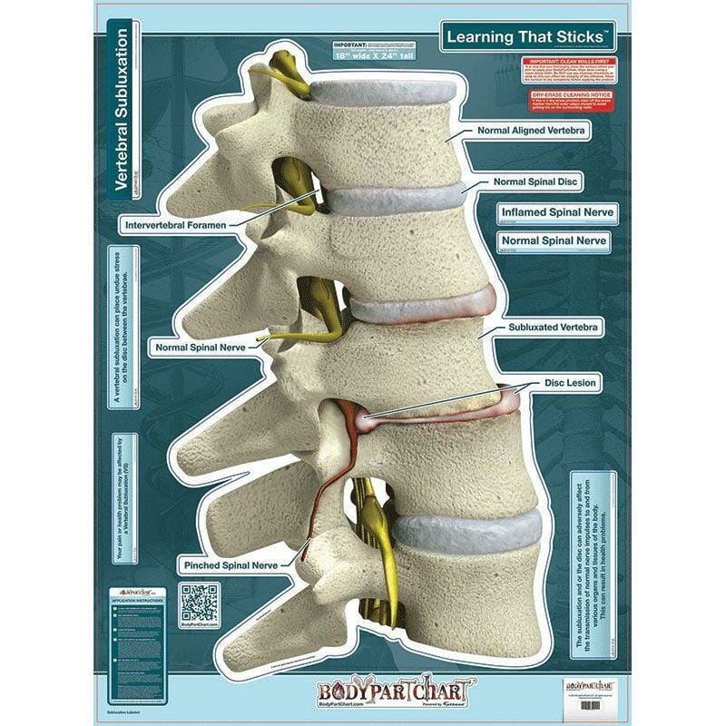 Subluxation - Labeled Removable Wall Graphic Subluxation - Labeled Removable Wall Graphic