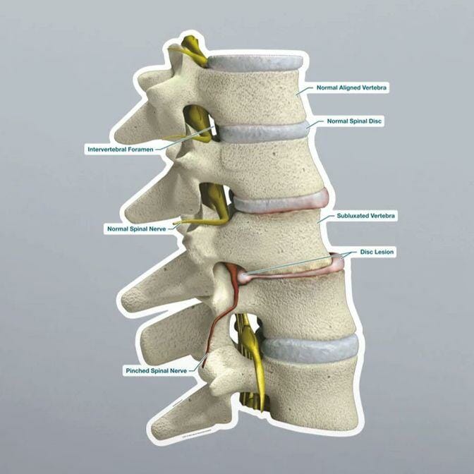 Subluxation - Labeled Removable Wall Graphic Subluxation - Labeled Removable Wall Graphic