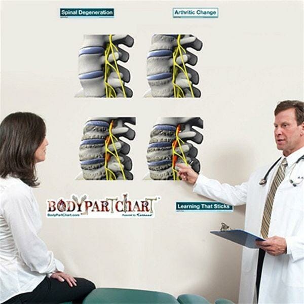 Spinal Degeneration Series - Removable Wall Graphic Spinal Degeneration Series - Removable Wall Graphic