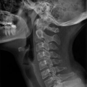 Digital X-Ray System with Installation & Training