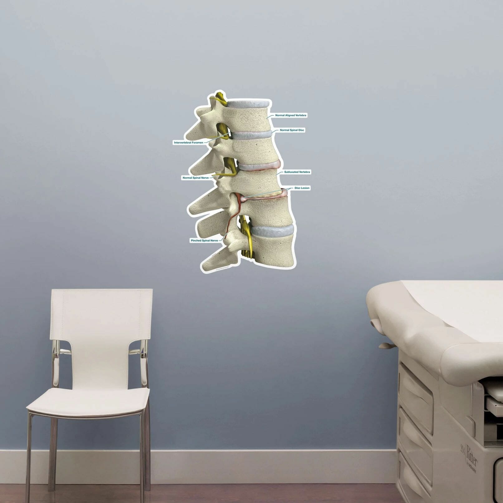 Subluxation - Labeled Removable Wall Graphic Subluxation - Labeled Removable Wall Graphic