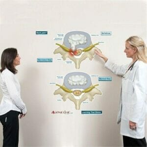 Prolapsed Disc - Labeled Removable Wall Graphic