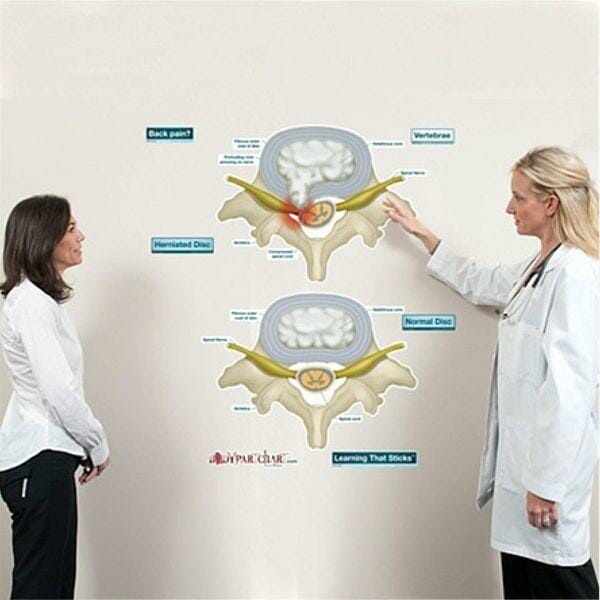 Prolapsed Disc - Labeled Removable Wall Graphic Prolapsed Disc - Labeled Removable Wall Graphic