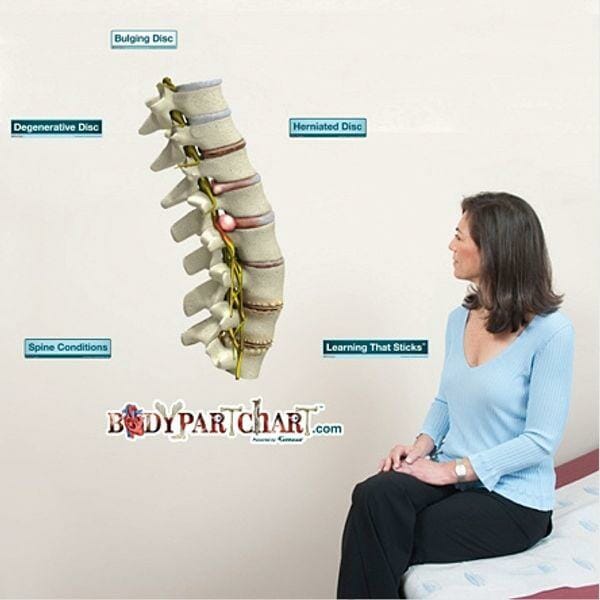 Spine Conditions - Removable Wall Graphic Spine Conditions - Removable Wall Graphic
