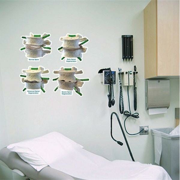 Spinal Degeneration - Labeled Removable Wall Graphic Spinal Degeneration - Labeled Removable Wall Graphic