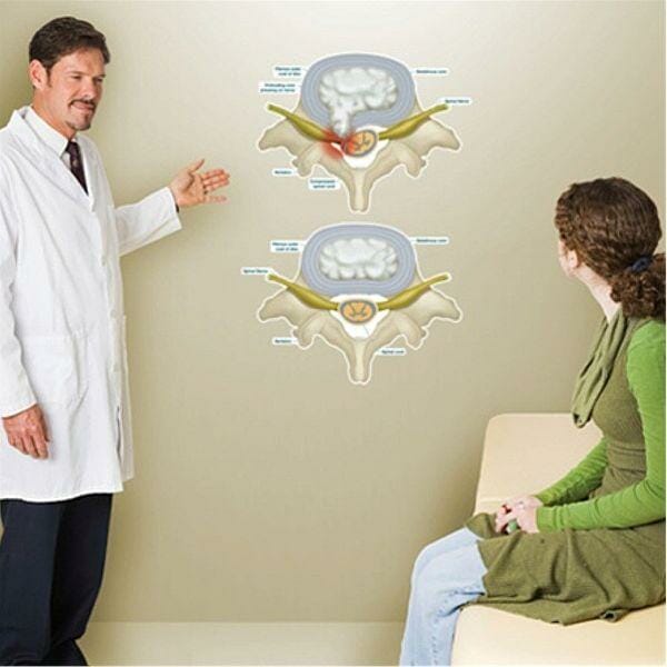 Prolapsed Disc - Labeled Removable Wall Graphic Prolapsed Disc - Labeled Removable Wall Graphic