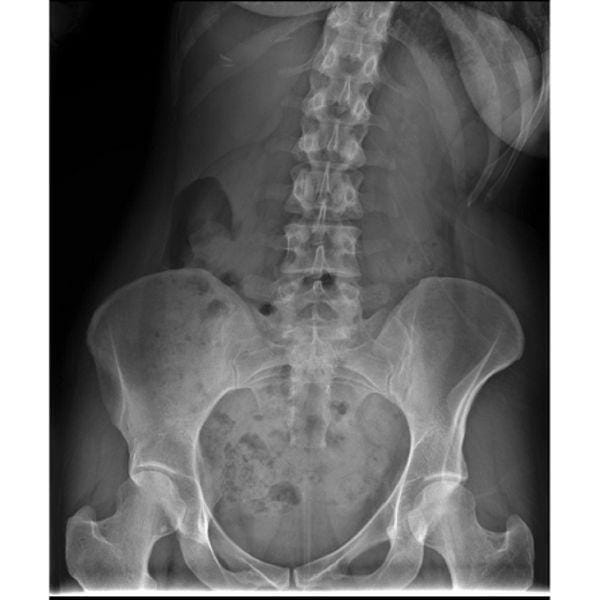 Digital X-Ray System with Installation & Training Digital X-Ray System with Installation & Training