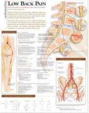 Understanding Low Back Pain Anatomical Chart