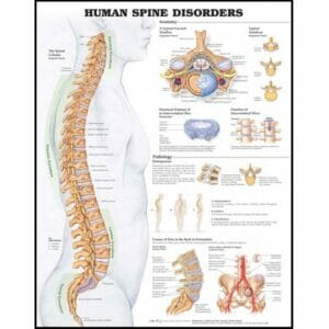 Human Spine Disorders Anatomical Chart